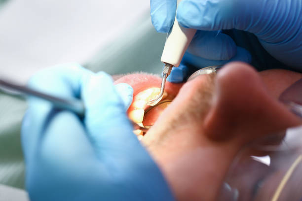 Best Emergency Tooth Extraction  in Meraux, LA