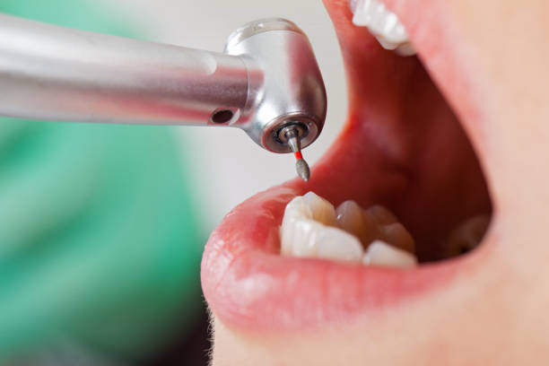Best Knocked-Out Tooth Emergency  in Meraux, LA